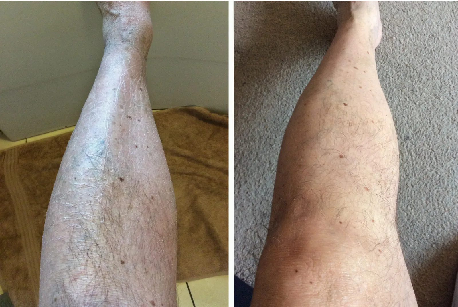 Skin before and after using G16 Skin Repair Lotion