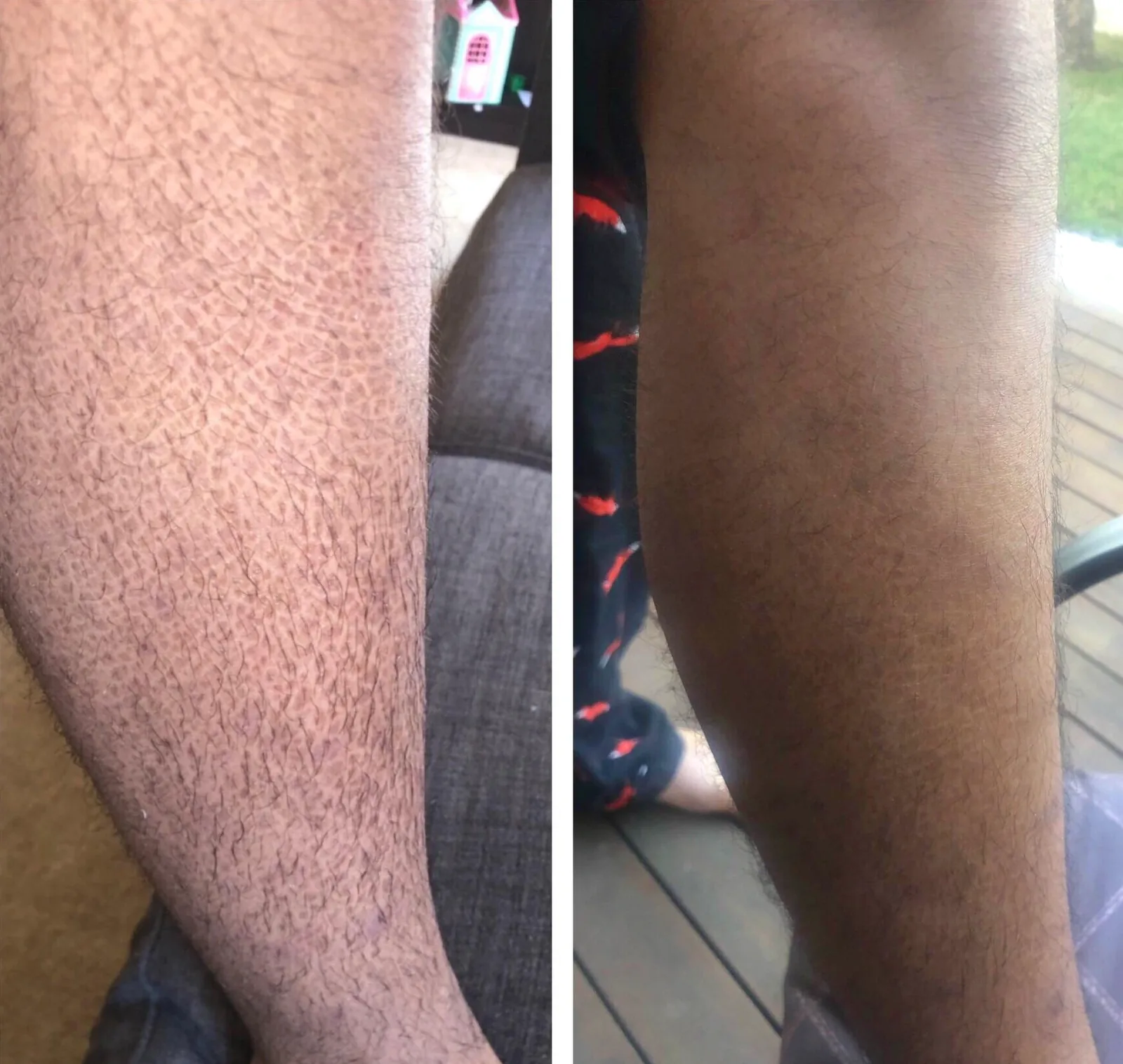 Skin before and after using G16 Skin Repair Lotion