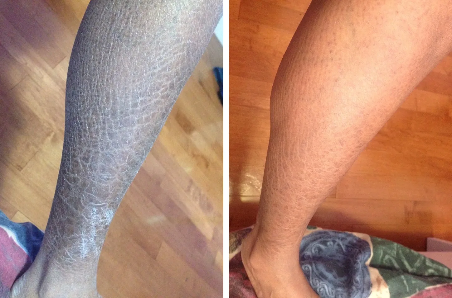 Skin before and after using G16 Skin Repair Lotion