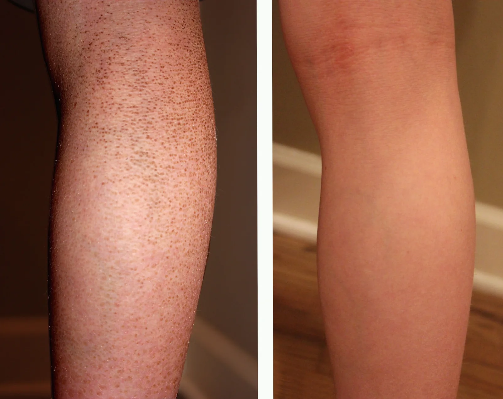 Skin before and after using G16 Skin Repair Lotion